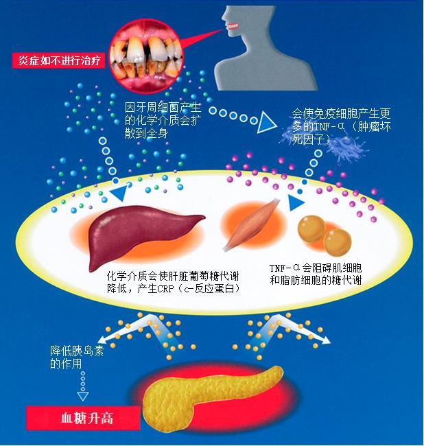间充质干细胞-治疗牙龈萎缩