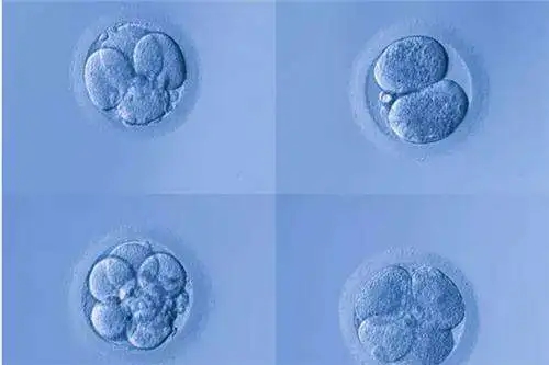 50岁试管婴儿，生下助孕10年后自杀，背后真相让人反思…