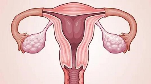 试管婴儿手续需要办什么，如何办？