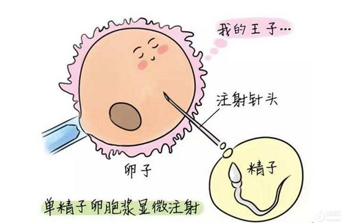 试管婴儿生孩子存在哪些风险？