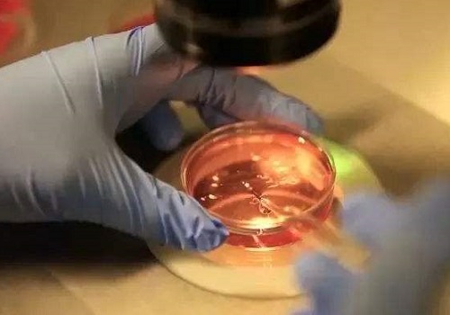 试管婴儿前补充叶酸有什么作用？试管婴儿费用多少？