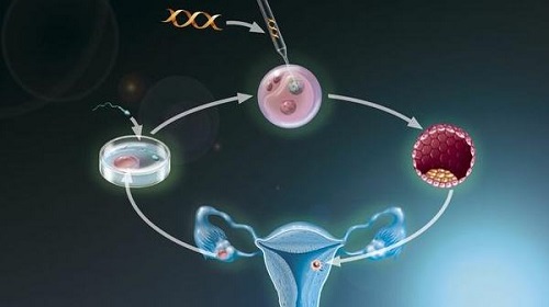 子宫腺肌症怀孕可能性及试管婴儿治疗周期