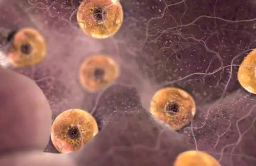 不明原因导致的不孕，试管婴儿助单胎怀孕成功