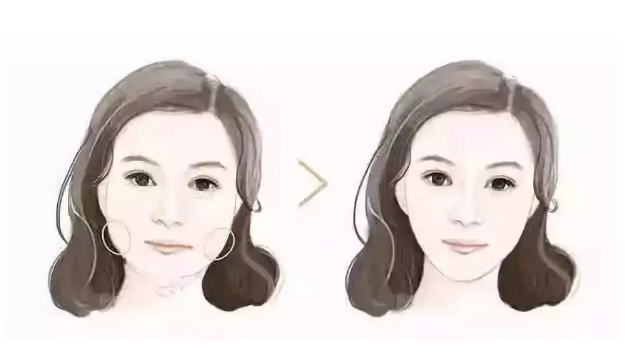 上海热玛吉哪家好?费用多少?能维持多久?