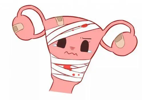 疤痕子宫也可以剖腹产生小孩，但产前这些事项和风险要先了解清楚