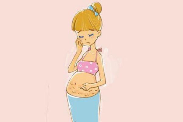 妊娠纹能修复吗 妊娠纹能淡化吗