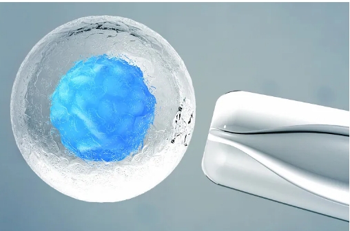 做试管**不打麻药会很疼吗?