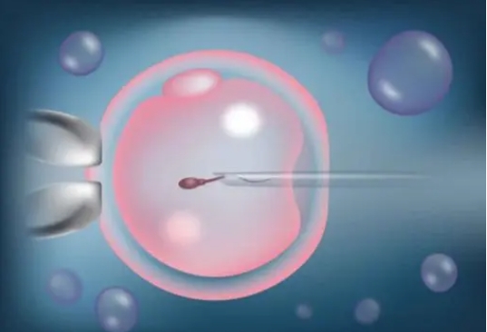 双侧输卵管不全梗阻是严重的不孕症吗?如何治疗?