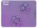 子宫内膜有问题要做哪些试管婴儿检查项目?
