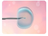 胚胎移植后手臂不能抬高是什么情况?原因是什么?