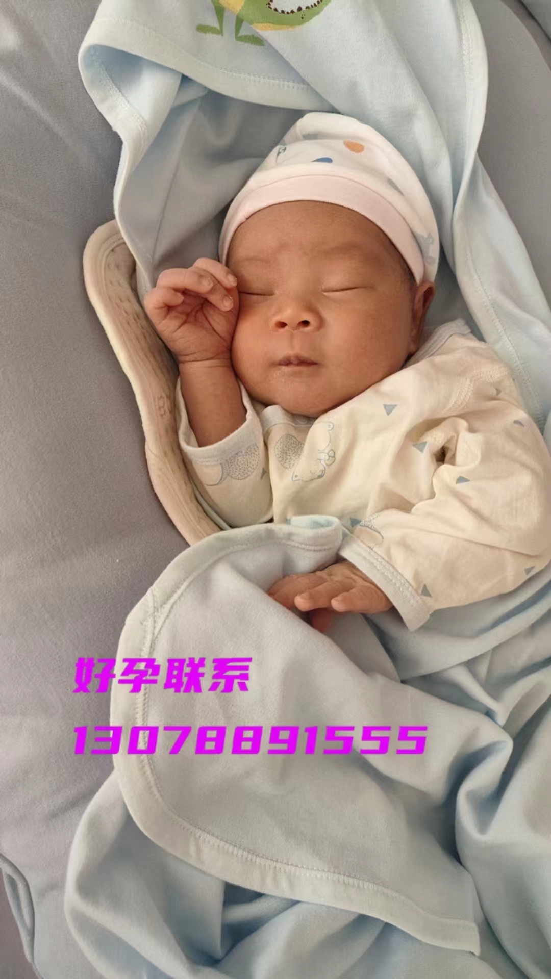 第三代试管婴儿技术，助力高龄生育之难(图1)
