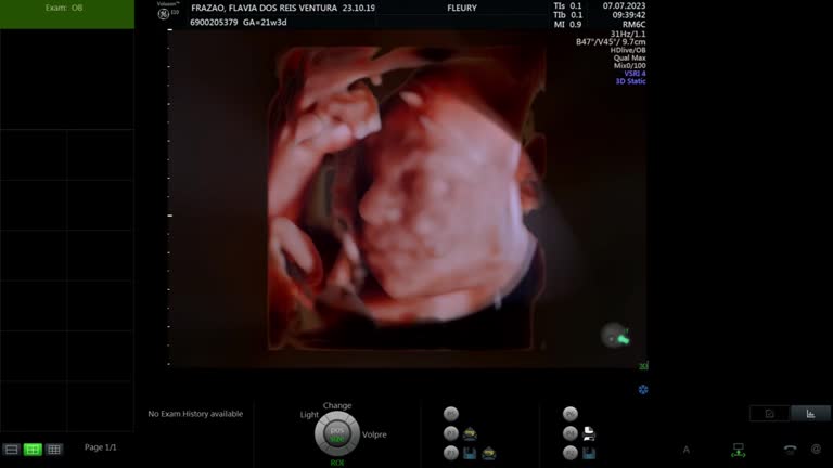 子宫息肉做试管婴儿费用是多少？