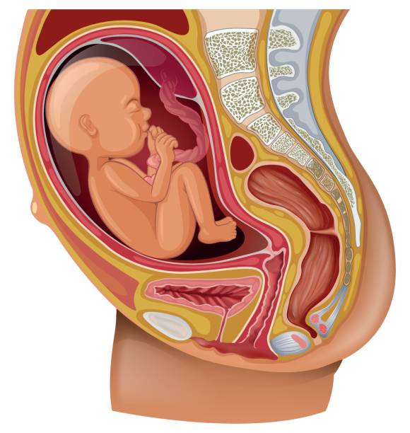 子宫内膜异位症做第三代试管婴儿怎么做？