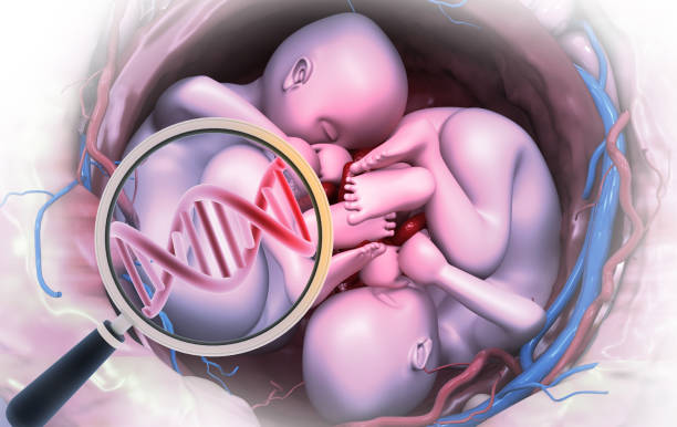 子宫肌腺症需要做试管婴儿吗？