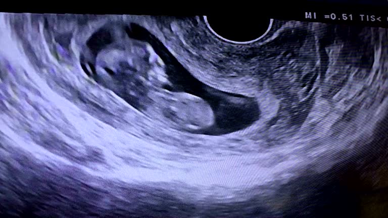 子宫纵隔可以去做试管婴儿吗？