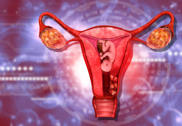 子宫腺肌病 做三代试管婴儿价格是多少？
