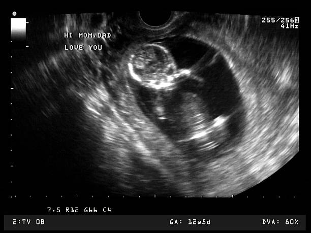 子宫腺肌病 做试管婴儿流程是什么样的？