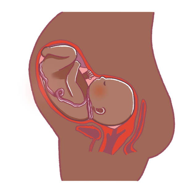 子宫肌瘤去泰国做试管婴儿费用是多少？