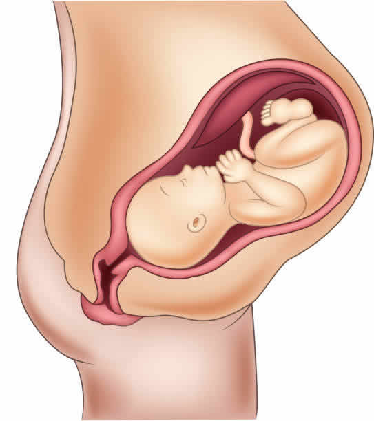 子宫畸形是一种常见的生殖系统畸形，对女性的生育能力产生一定影响。近年来，随着辅助生殖技术的不断发展，第三代试管婴儿技术为子宫畸形患者带来了新的希望。那么，子宫畸形做第三代试管婴儿的费用是多少呢？本文将从以下几个方面为您详细介绍。