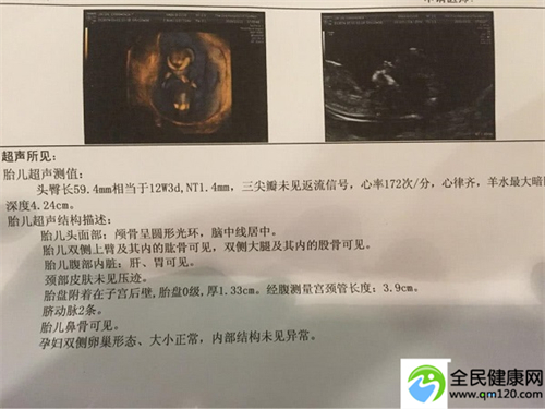 泰国医院第三代试管（怎么样去泰国做三代试管）