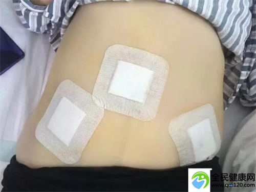 地贫广州做三代试管婴儿