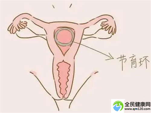 三代试管广州还是湖南好