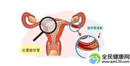 广州三代试管费用排名表