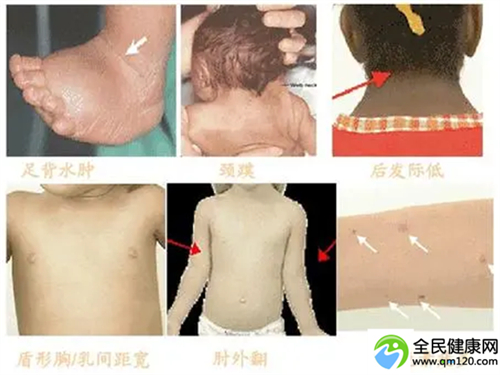 广州三代试管卵巢，广州私立三代试管选择