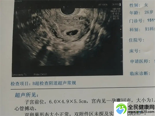 广州三代试管多少钱一个