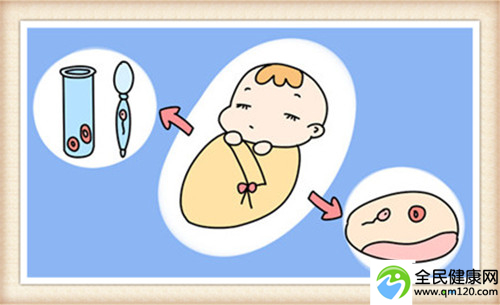 同性试管促排，青岛同性试管医院