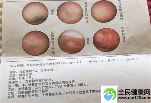 单身女性试管（单身试管mary）