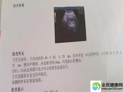 做三代试管婴儿武汉[武汉三代试管医生名单大全]