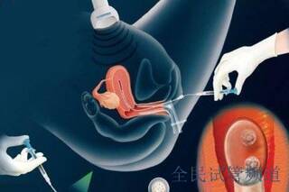 2025辽宁试管**费用揭晓,总花销8-15万元
