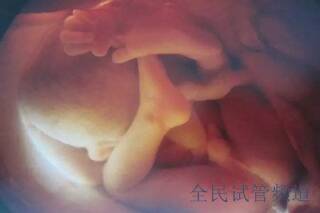 合肥2025试管医院排行,基因筛查技术对比分析