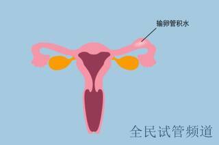 南宁试管助孕机构推荐,让好孕触手可及