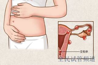 高龄曲靖三代试管婴儿助孕怎么样?