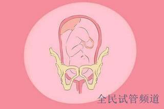 陇南做三代试管婴儿助孕都有哪些要求？