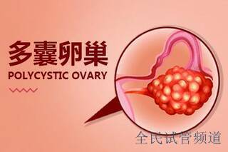 多囊能不能在北京三代试管婴儿助孕做成功？