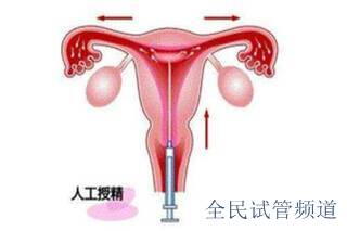 九江三代试管婴儿助孕影响获卵因素