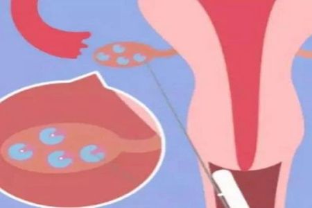 昆明试管婴儿私人医院排名：比较专业的选择