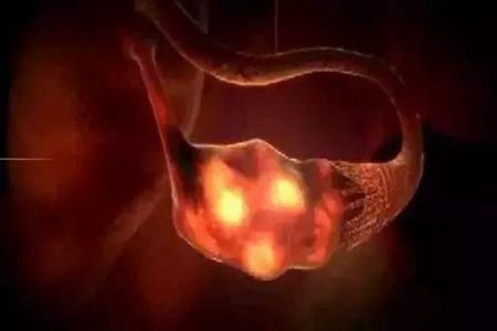 国内三代试管婴儿需要多少天?