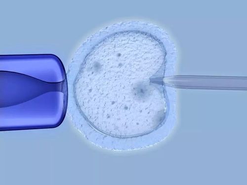 第一代试管:第一代试管有技术分辨是男是女吗？