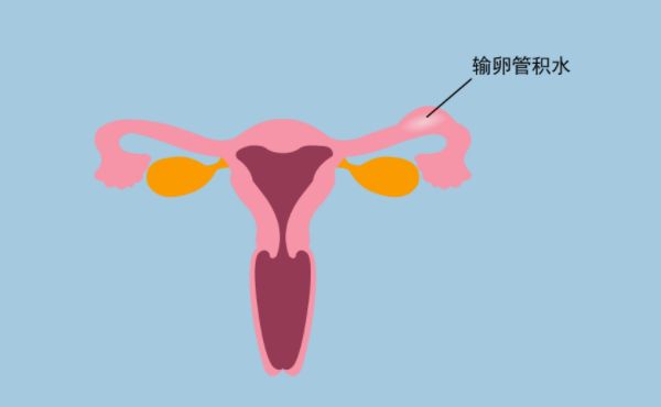 泰国试管婴儿费用大比拼，哪家更实惠