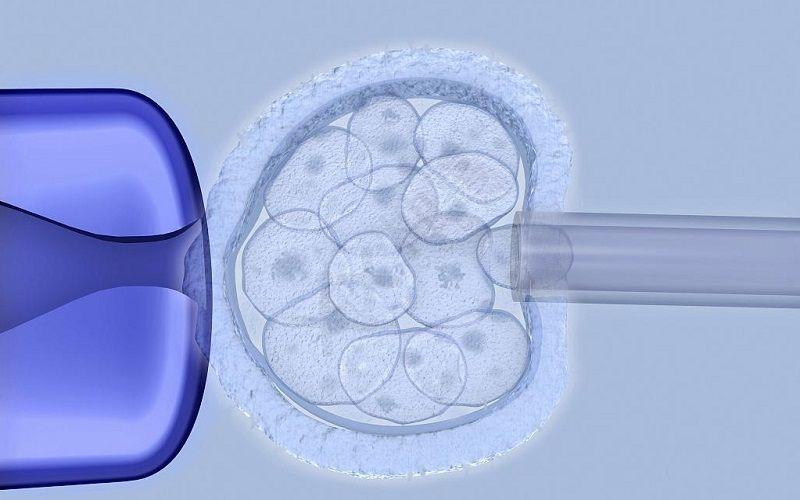 大连残角子宫试管:大连残角子宫治疗