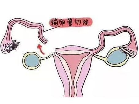 试管婴儿在北京可以上医保吗？试管婴儿在北京可以上医保吗？