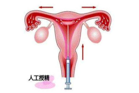 重庆江津区试管婴儿哪家好