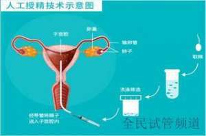 泰国试管三代费用预算，轻松圆梦宝宝,助您快速拥有健康宝贝