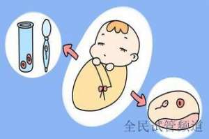 泰国试管价格透明吗,揭秘隐藏费用真相