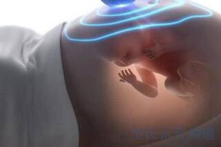 2025俄罗斯试管婴儿染色体查技术解析与优势