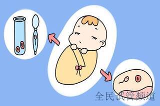 2024吉尔吉斯试管费用解析,助孕预算全攻略